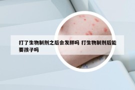 打了生物制劑之后會發(fā)胖嗎 打生物制劑后能要孩子嗎
