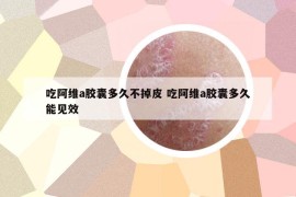 吃阿維a膠囊多久不掉皮 吃阿維a膠囊多久能見效