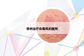 鄭州治療白癜風(fēng)的醫(yī)院