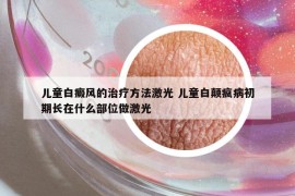 兒童白癜風(fēng)的治療方法激光 兒童白顛瘋病初期長(zhǎng)在什么部位做激光