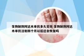 生物制劑阿達(dá)木單抗多久見效 生物制劑阿達(dá)木單抗注射四個月以后還會恢復(fù)嗎