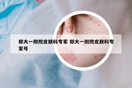 鄭大一附院皮膚科專家 鄭大一附院皮膚科專家號