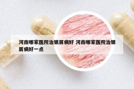 河南哪家醫(yī)院治銀屑病好 河南哪家醫(yī)院治銀屑病好一點