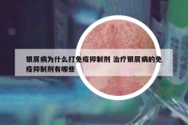 銀屑病為什么打免疫抑制劑 治療銀屑病的免疫抑制劑有哪些