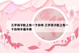 三歲孩子臉上有一個(gè)白塊 三歲孩子臉上有一個(gè)白塊不痛不癢