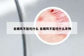 自癜風不能吃什么 自癜風不能吃什么食物