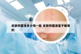 皮膚抑菌液多少錢一瓶 皮膚抑菌液是干嘛用的