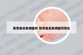 新蔡縣皮膚病醫(yī)院 新蔡縣皮膚病醫(yī)院地址