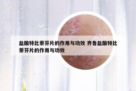 鹽酸特比萘芬片的作用與功效 齊魯鹽酸特比萘芬片的作用與功效