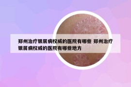 鄭州治療銀屑病權(quán)威的醫(yī)院有哪些 鄭州治療銀屑病權(quán)威的醫(yī)院有哪些地方