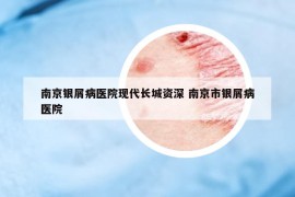 南京銀屑病醫(yī)院現(xiàn)代長城資深 南京市銀屑病醫(yī)院