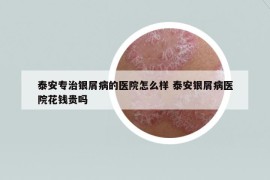 泰安專治銀屑病的醫(yī)院怎么樣 泰安銀屑病醫(yī)院花錢貴嗎