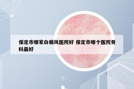 保定市哪家白癜風醫(yī)院好 保定市哪個醫(yī)院骨科最好
