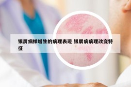 銀屑病樣增生的病理表現(xiàn) 銀屑病病理改變特征