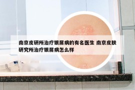 南京皮研所治療銀屑病的有名醫(yī)生 南京皮膚研究所治療銀屑病怎么樣