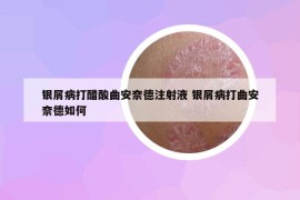銀屑病打醋酸曲安奈德注射液 銀屑病打曲安奈德如何