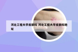 河北工程大學(xué)皮膚科 河北工程大學(xué)皮膚科地址