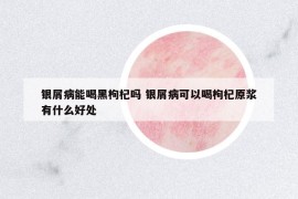 銀屑病能喝黑枸杞嗎 銀屑病可以喝枸杞原漿有什么好處