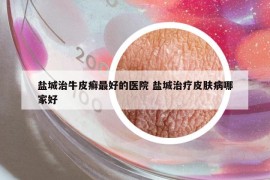 鹽城治牛皮癬最好的醫(yī)院 鹽城治療皮膚病哪家好