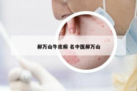 郝萬山牛皮癬 名中醫(yī)郝萬山