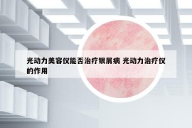 光動力美容儀能否治療銀屑病 光動力治療儀的作用