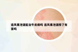 追風(fēng)果泡酒能治牛皮癬嗎 追風(fēng)果泡酒擦了有害嗎