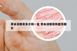 草本消銀膏多少錢一盒 草本消銀膏陳醫(yī)生圖片