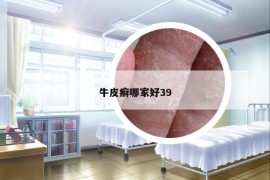 牛皮癬哪家好39