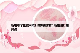 新疆哪個醫(yī)院可以打銀屑病的針 新疆治療銀屑病