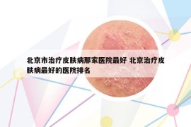 北京市治療皮膚病那家醫(yī)院最好 北京治療皮膚病最好的醫(yī)院排名