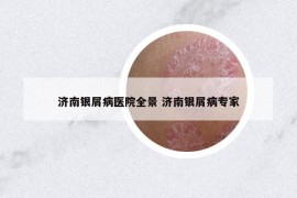濟南銀屑病醫(yī)院全景 濟南銀屑病專家