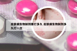 皮膚病生物制劑要打多久 皮膚病生物制劑多久打一次