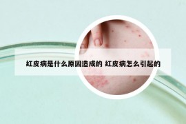 紅皮病是什么原因造成的 紅皮病怎么引起的