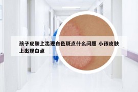 孩子皮膚上出現(xiàn)白色斑點(diǎn)什么問(wèn)題 小孩皮膚上出現(xiàn)白點(diǎn)