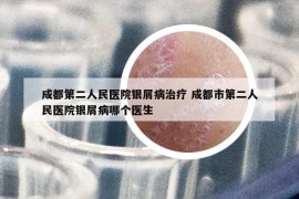 成都第二人民醫(yī)院銀屑病治療 成都市第二人民醫(yī)院銀屑病哪個醫(yī)生