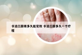 卡泊三醇用多久能見效 卡泊三醇多久一個(gè)療程