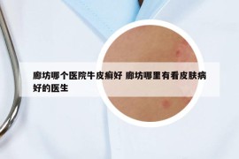 廊坊哪個(gè)醫(yī)院牛皮癬好 廊坊哪里有看皮膚病好的醫(yī)生