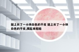 腿上長了一小塊白色的干皮 腿上長了一小塊白色的干皮,摸起來粗糙