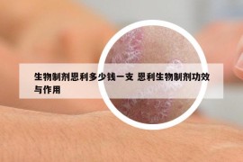 生物制劑恩利多少錢一支 恩利生物制劑功效與作用