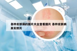 各種皮膚病的圖片大全查看圖片 各種皮膚病真實照片
