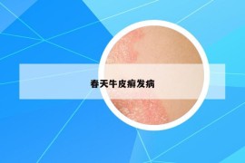 春天牛皮癬發(fā)病