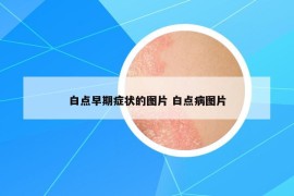 白點(diǎn)早期癥狀的圖片 白點(diǎn)病圖片