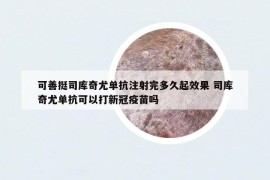 可善挺司庫奇尤單抗注射完多久起效果 司庫奇尤單抗可以打新冠疫苗嗎