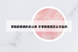 掌跖膿皰病的忌口表 手掌膿皰病怎么引起的