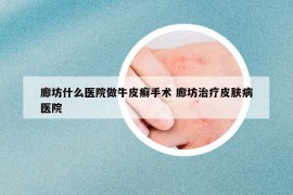 廊坊什么醫(yī)院做牛皮癬手術(shù) 廊坊治療皮膚病醫(yī)院