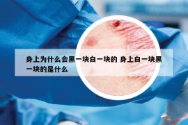 身上為什么會黑一塊白一塊的 身上白一塊黑一塊的是什么