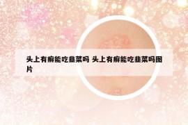 頭上有癬能吃韭菜嗎 頭上有癬能吃韭菜嗎圖片