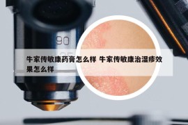 牛家傳敏康藥膏怎么樣 牛家傳敏康治濕疹效果怎么樣