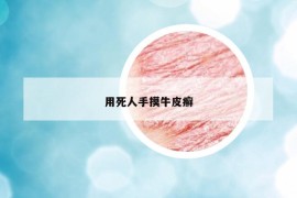 用死人手摸牛皮癬