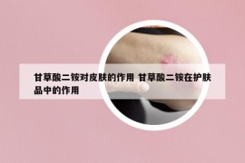 甘草酸二銨對皮膚的作用 甘草酸二銨在護膚品中的作用
